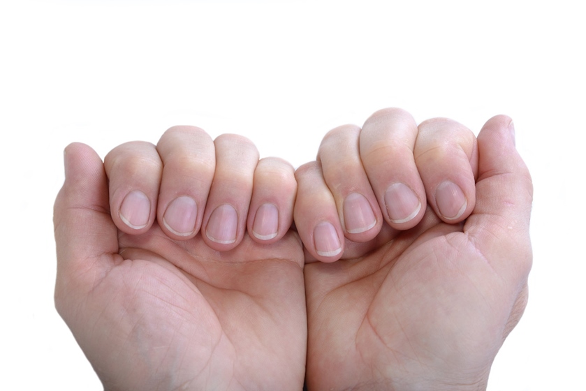 Foto colorida de mãos femininas em que aparecem unhas - Metrópoles