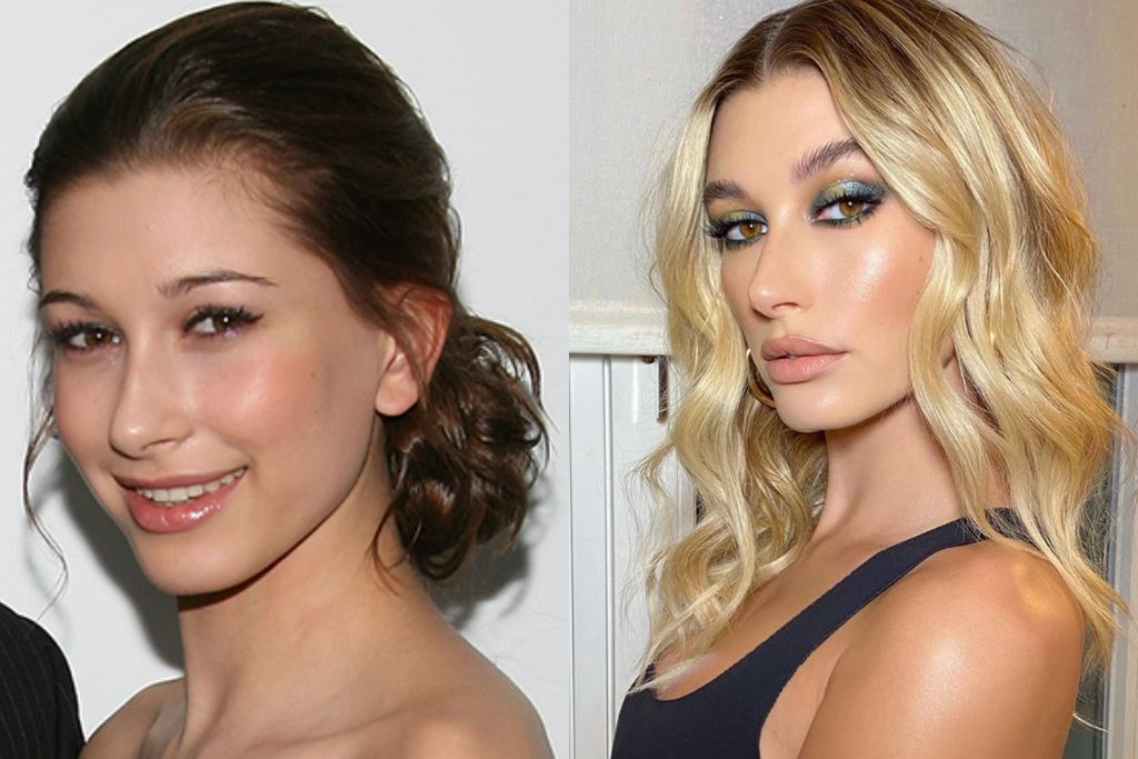 antes e depois da modelo Hailey Bieber