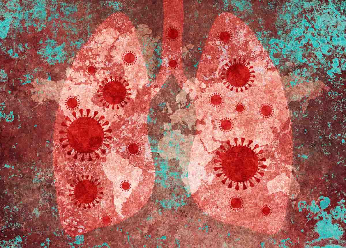 arte coronavirus COVID-19 mundo mundial