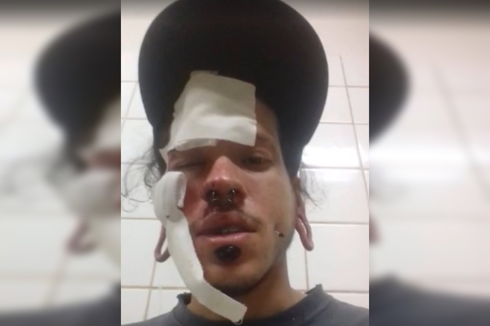 homem ferido