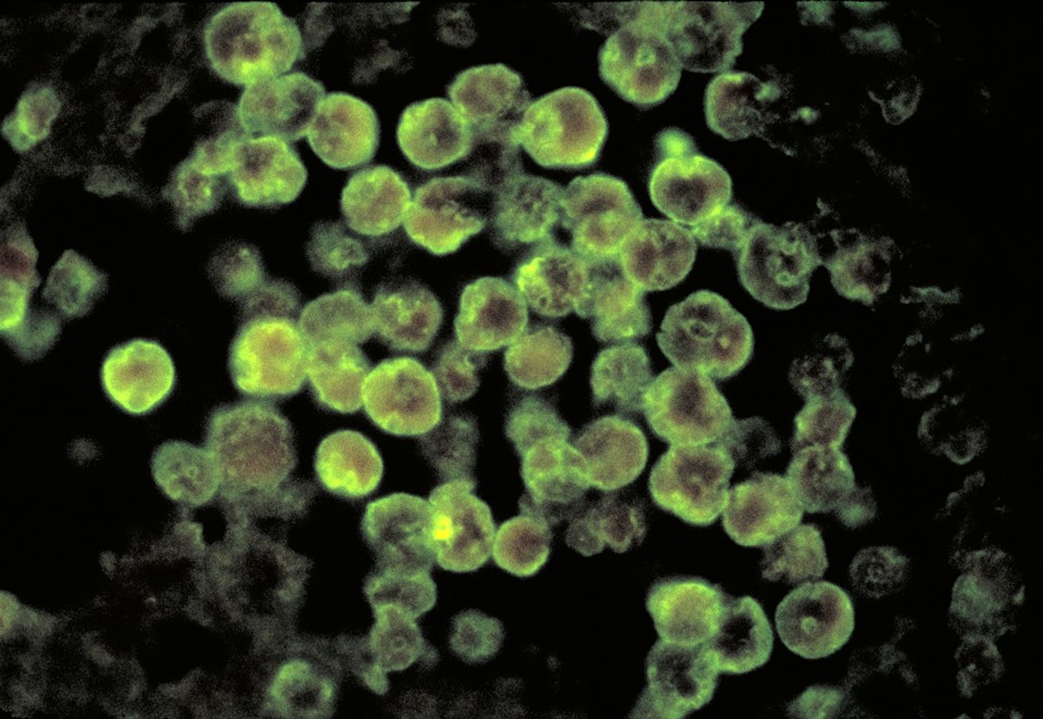 Ameba Naegleria fowleri