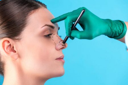 rinoplastia