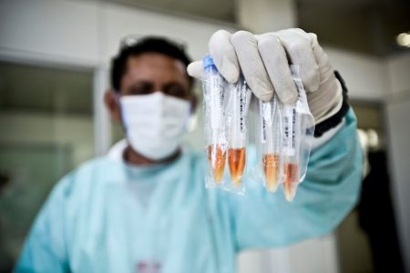 PCR
