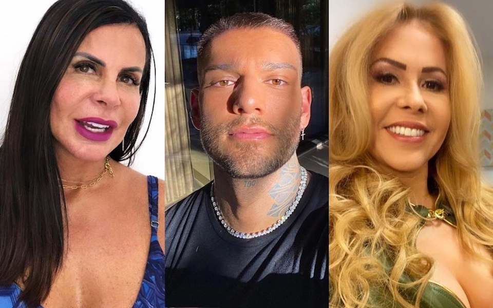 harmonizacao facial famosos