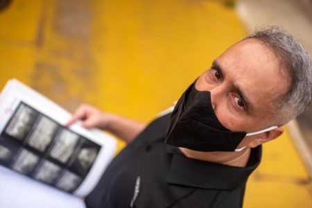 Alexandre Hamilton, paciente de câncer de mama