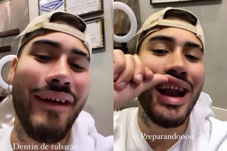 Kevinho sem lentes de contato nos dentes