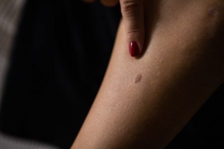 Mulher aponta para mancha