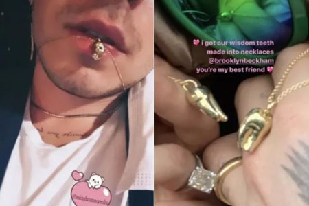 Noiva de Brooklyn Beckham transforma dentes do casal em pingentes de ouro