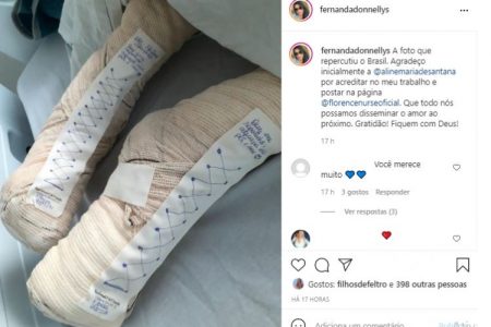 Sapatos de gaze e esparadrapo viralizaram nas redes sociais