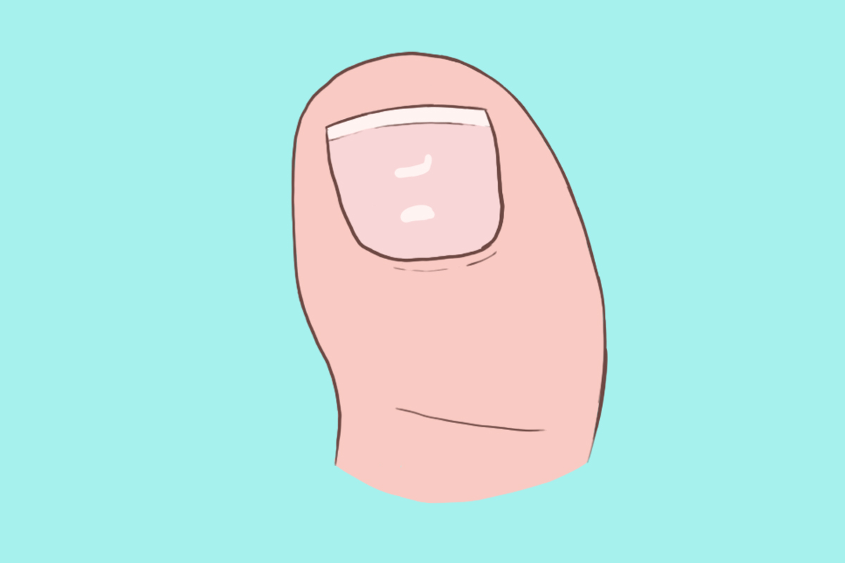 Unhas com manchas brancas