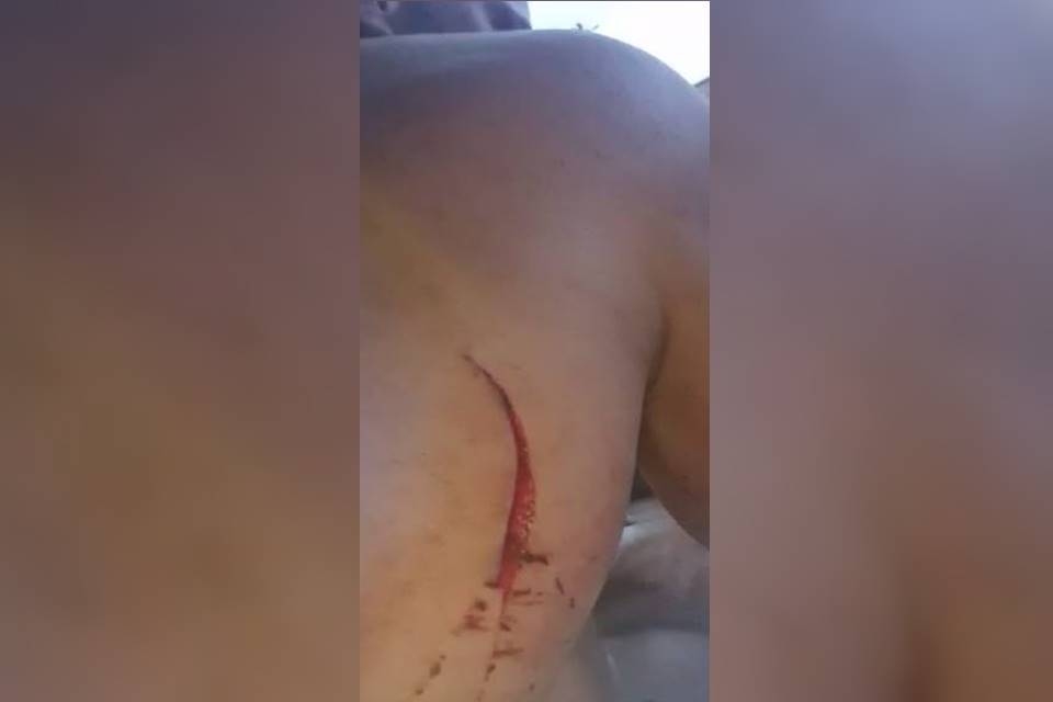 Homem é ferido por ex-namorada com canivete