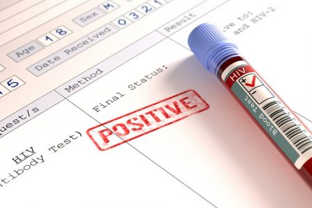 HIV