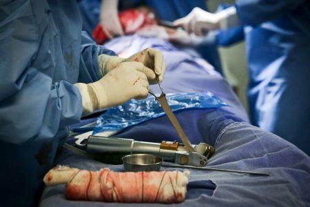 médicos realizando transplante