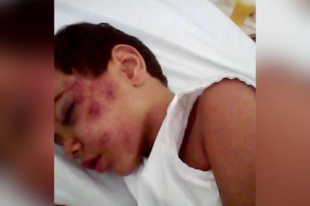 criança queda toboágua caldas novas (15)