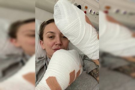 Mulher com mãos enfaixadas