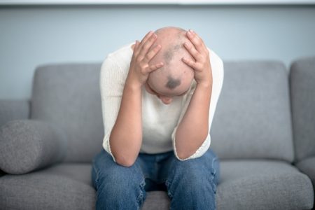 Pessoa sentada em um sofá olhando para baixo. Ela tem a cabeça raspada alopecia - Metrópoles