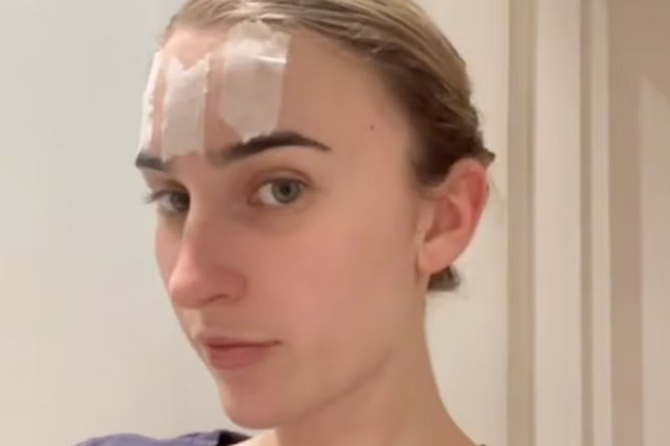 Face taping