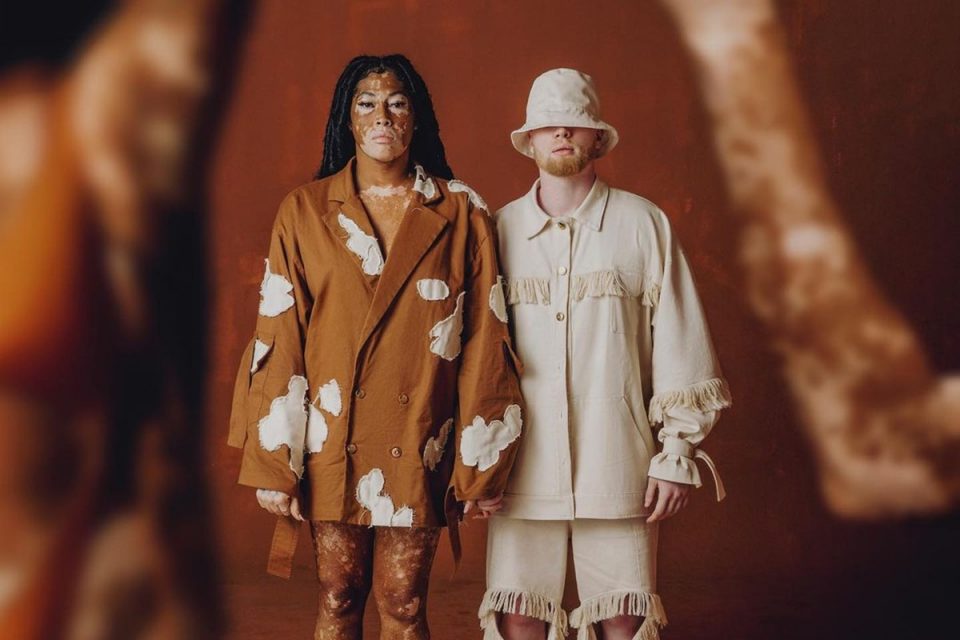 Modelo negra com vitiligo, de mãos dadas com modelo branco. Ela usa blazer oversized marrom estampado. Ele veste look off-white com franjas na jaqueta e em recorte nos joelhos, além de bucket hat
