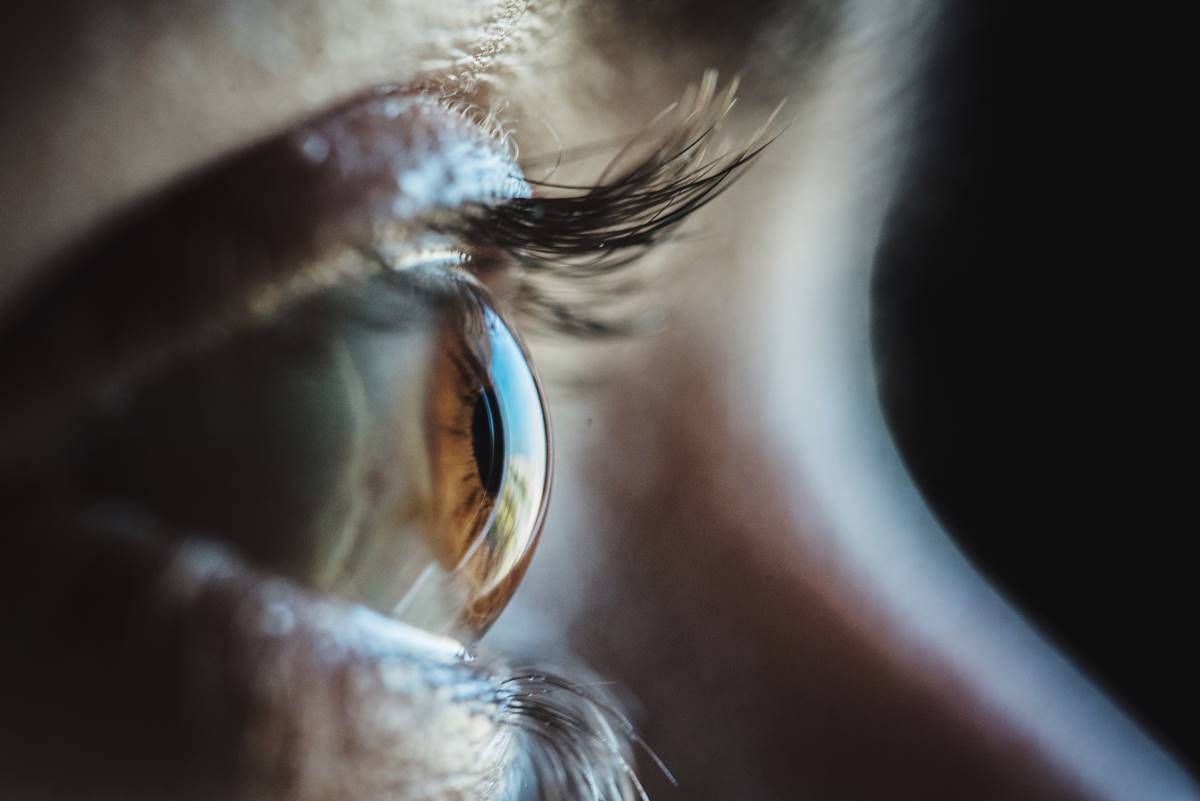 Olhos ceratocone