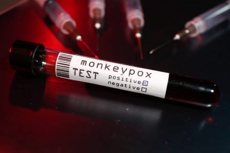 imagem de tubos de ensaio sinalizando resultado positivo para varíola dos macacos - Metrópoles - mpox