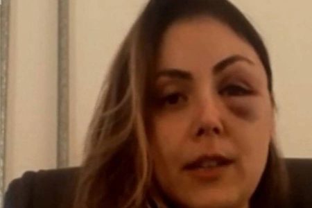 A procuradora-geral Gabriela Samadello Monteiro de Barros, de 39 anos, começou a ser agredida inicialmente com socos e uma cotovelada no rosto pelo também procurador Demétrius Oliveira Macedo, de 34 anos