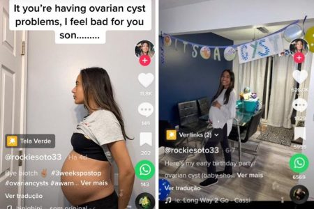 duas fotos colorida de mulher mostrando a barriga