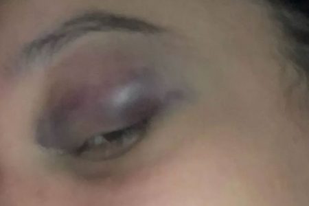Mulher é agredida no Jockey Club do Rio
