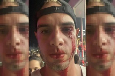 Fotógrafo é agredido no Rock in Rio