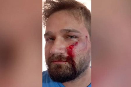 médico agredido em aragoiânia, goiás, por negar atestado de três dias