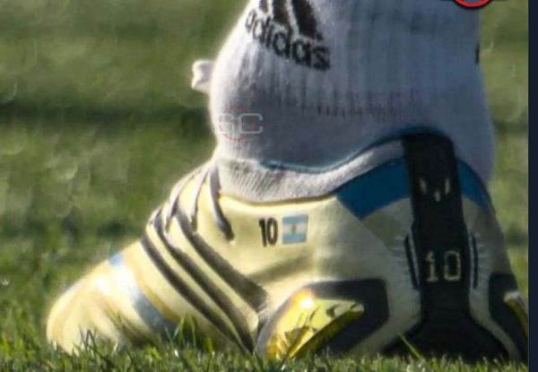 O tornozelo do jogador argentino Lionel Messi em destaque, inchado e com forma circular. Ele usa chuteira amarela - Metrópoles