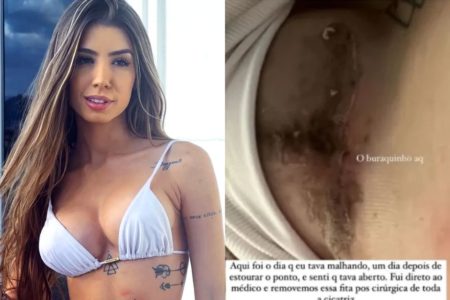 Maria Lina mostra problema no silicone