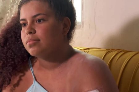 Foto colorida de Kaylanne Timóteo Freitas que perdeu parte do braço após ataque de tubarão - Metrópoles