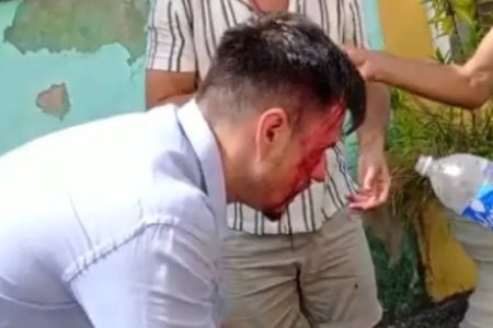 Foto colorida de turista machucado após assalto no Pelourinho - Metrópoles