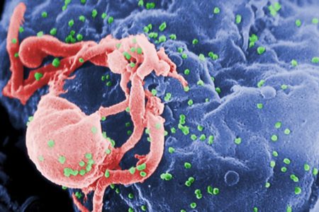 Imagem colorida de microscópio mostra o vírus HIV infectando linfócitos - Metrópoles