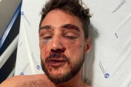 Foto colorida de Jefferson Gomes Tenório, agredido por seguranças de um bar em Lisboa - Metrópoles