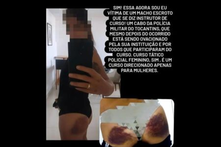 Imagem mostra policial que denunciou ter sido agredida por instrutor de curso no Ceará - Metrópoles