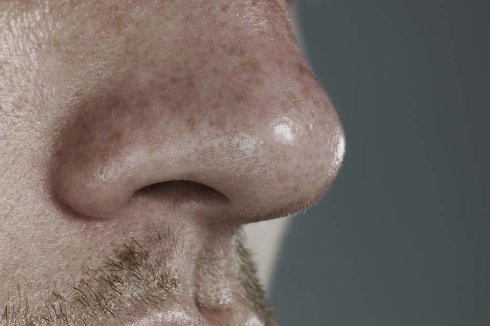 Foto e,m close de nariz de homem - Metrópoles