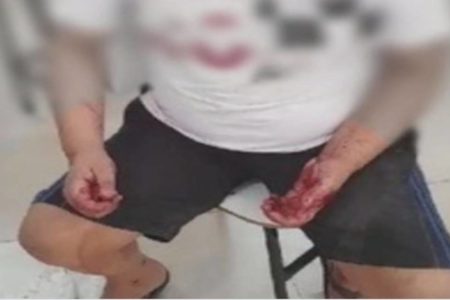 Imagem mostra Aluno autista é agredido por professor durante surto em escola estadual - Metrópoles