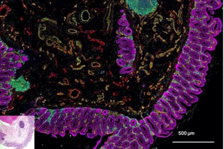 Imagem colorida de células que revestem e as de dentro do intestino destacadas em roxo e em tons azuis e verdes