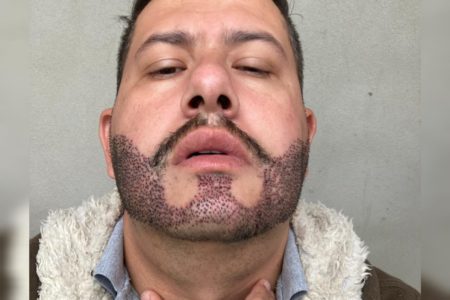 Foto mostra o rosto de um homem com close-up em sua barba