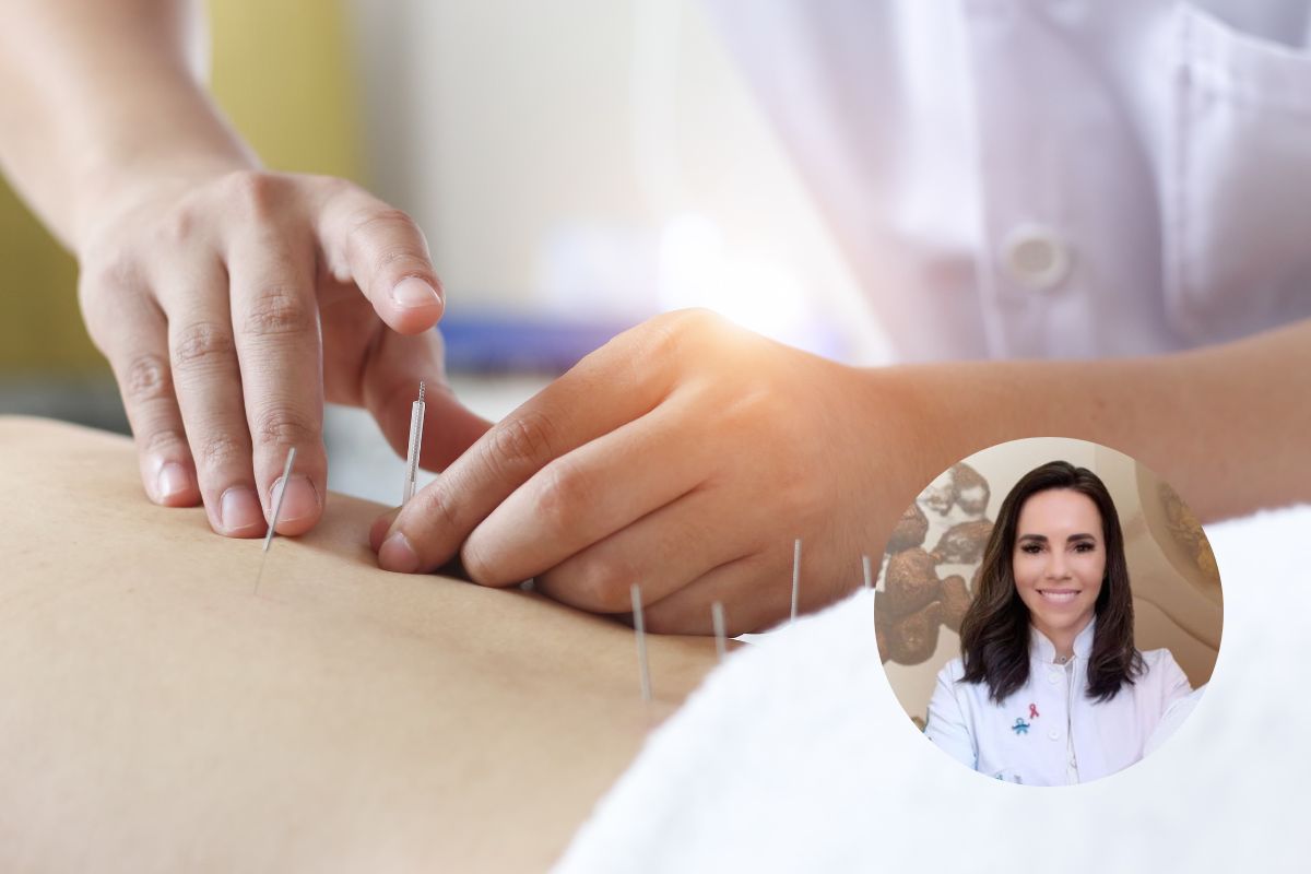 Foto colorida. Imagem mostra uma mão aplicando agulhas de acupuntura no corpo de um paciente - Metrópoles