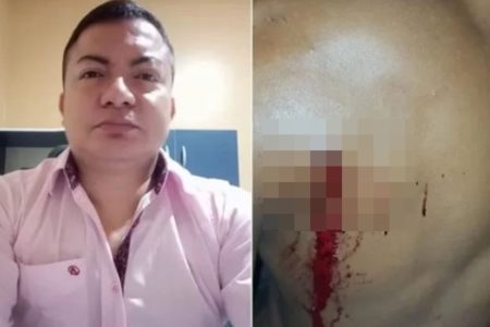 Foto colorida de vereador preso por tentativa de assassinato no Pará - Metrópoles