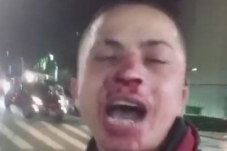 Imagem mostra homem com rosto ensanguentado. Agressão contra jovem gerou protesto de entregadores na frente de prédio - Metrópoles