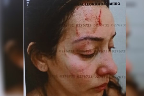 Fotos mostram como ficou vítima de violência