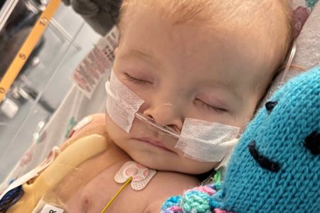 Foto mostra bebê com equipamentos médicos no corpo. Trata-se de Ava-Rose Lake, bebê com malformação cardíaca descoberta através do ronco - Metrópoles