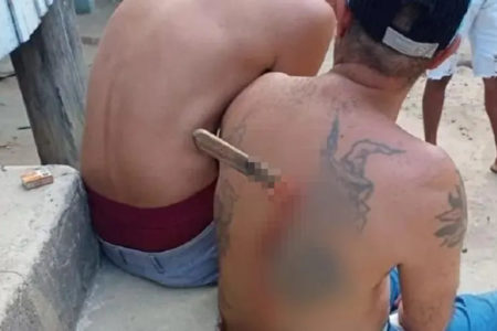 Homem ficou com faca presa nas costas em Vila Valério (ES)