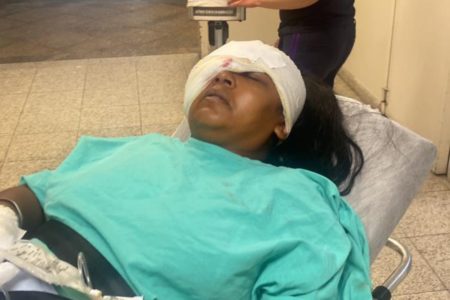 Imagem colorida de mulher negra, em cima de maca hospitalar, com curativo no olho após ser baleada por um PM - Metrópoles