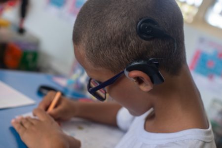 Foto colorida de criança com o implante na cabeça