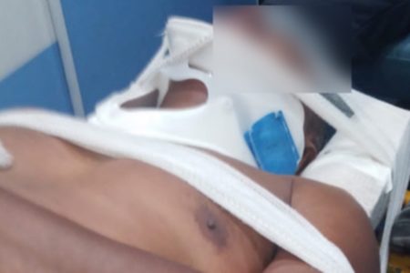 Motorista de ônibus é agredido por motociclista com socos e golpes de capacete em briga de trânsito