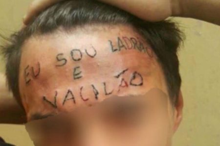 Imagem colorida mostra Ruan Rocha da Silva teve a testa tatuada em 2017 com a frase "sou ladrão e vacilão" - Metrópoles